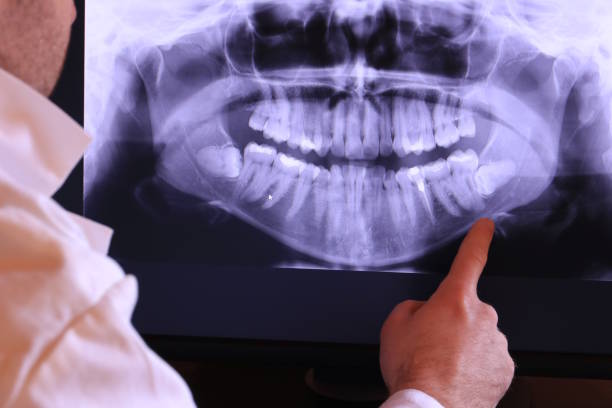 Best Emergency Tooth Extraction in Stamps, AR