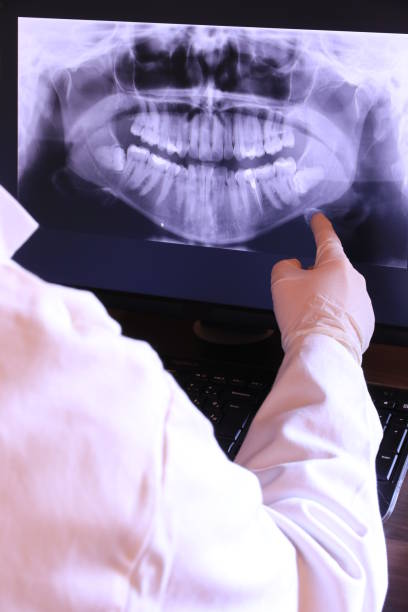 Best Emergency Wisdom Teeth Removal in Stamps, AR