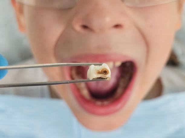 Best Same-Day Emergency Dentist in Stamps, AR